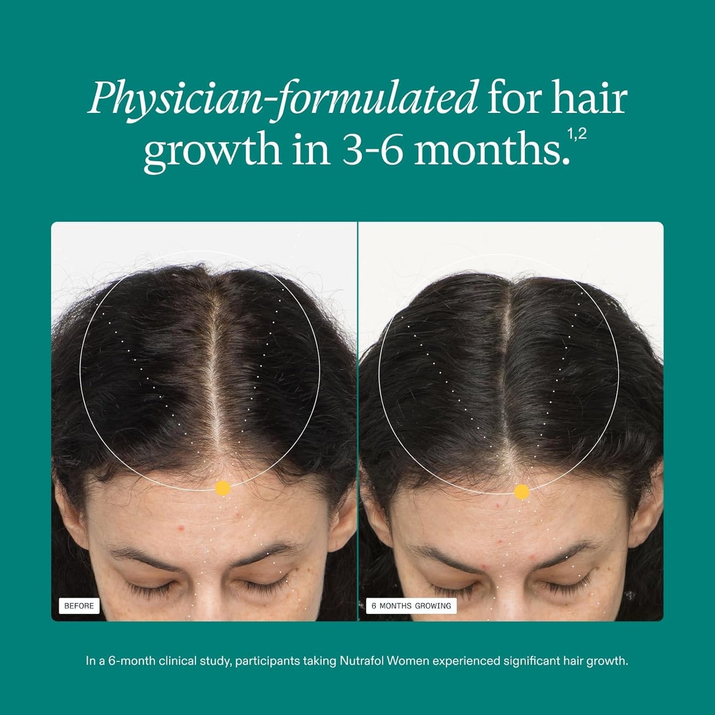 Nutrafol Women's Hair Growth Supplements, Ages 18-44, Clinically Tested for Visibly Thicker and Stronger Hair, Dermatologist Recommended - 1 Month Supply